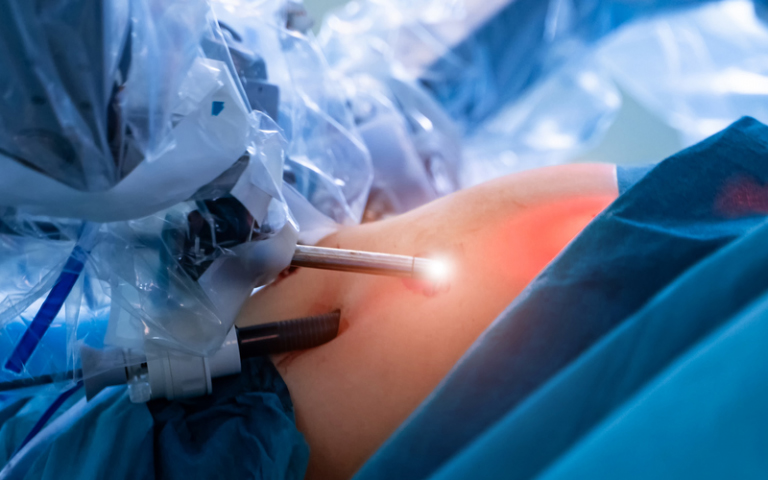 Istock robotic surgery2